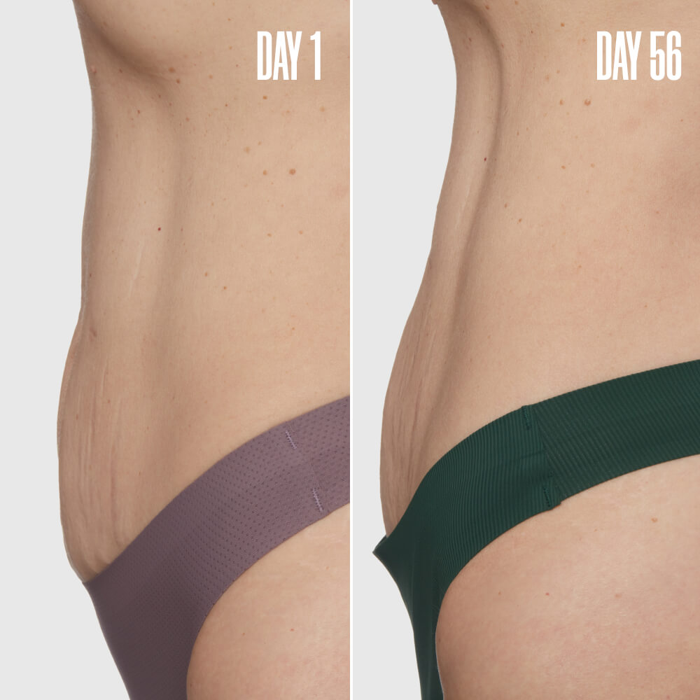 The Loose Skin Bundle package